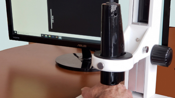 The virtual biopsy prototype device can distinguish between healthy skin and different types of skin lesions and carcinomas.