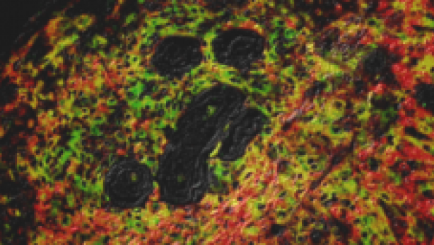 Parasitic worm surrounded by immune system cells